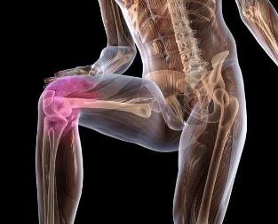 Inflamación da articulación do xeonllo con artrose