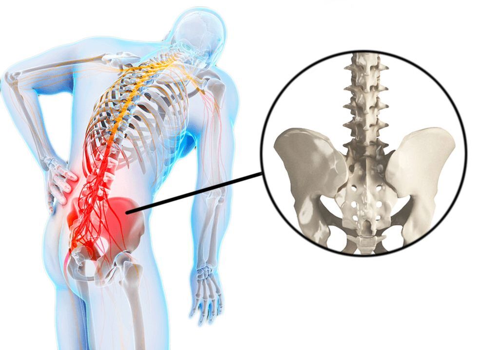 dor lumbar