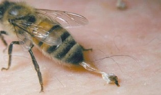 tratamento da artrose da cadeira por parte das abellas
