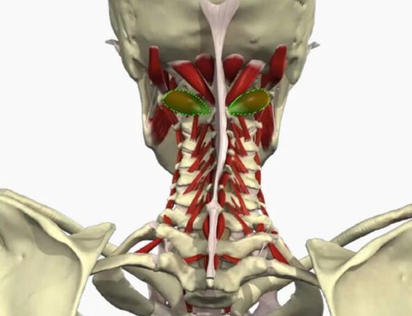 Síndrome da arteria vertebral